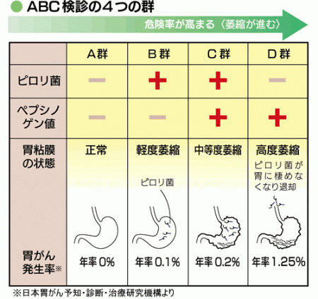 abc検査